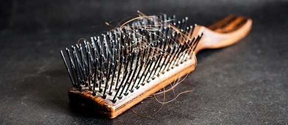 Îmi cade părul, ce mă&nbsp;fac?